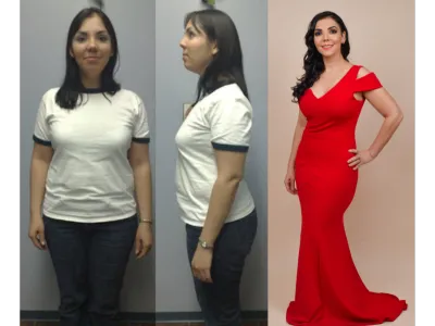 Antes y después de Berenice Bastidas